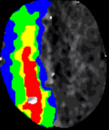Gehirnscan linke Seite