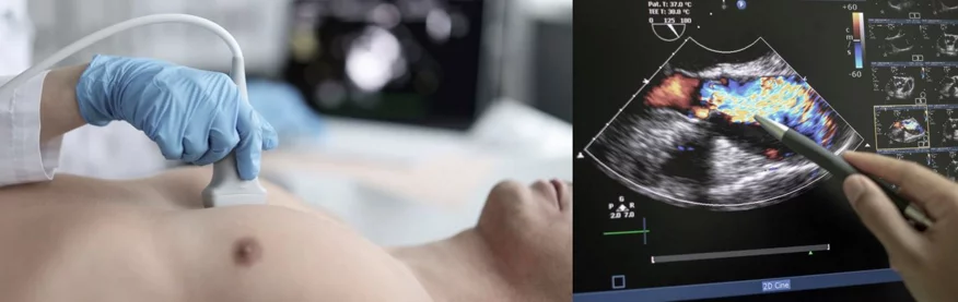 Symbolbild Ultraschalluntersuchung und Bildgebung