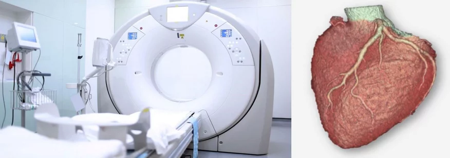 CT-Scanner und Bildgebung davon