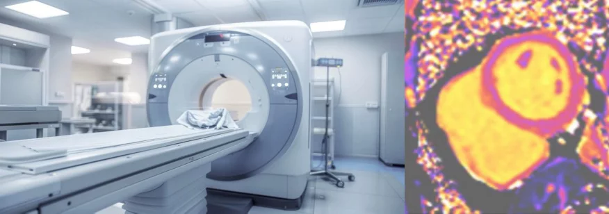 MRI-Röhre und Bildgebung davon