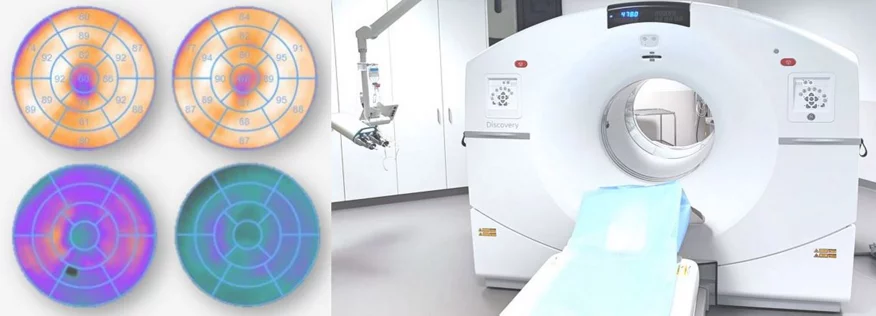 PET-Scanner und Bildgebung davon