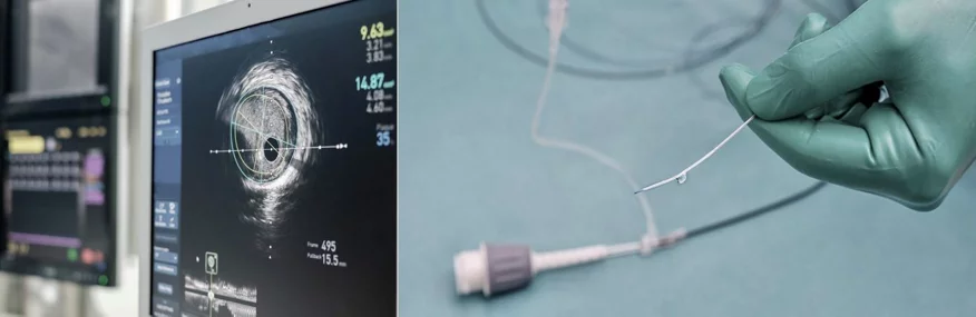 Darstellung auf Bildschirm und Nahaufnahme Katheter für die optische Koheränztomographie